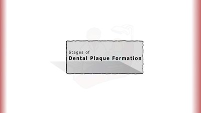 Stages of Dental Plaque Formation (Screencast)