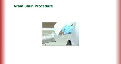 Gram Stain Procedure (Screencast)